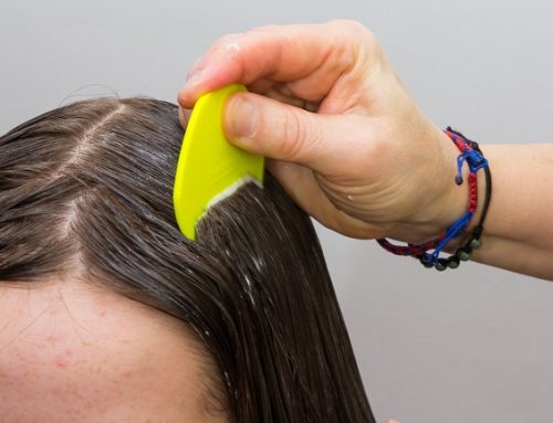 Cara Menghilangkan Kutu Rambut
